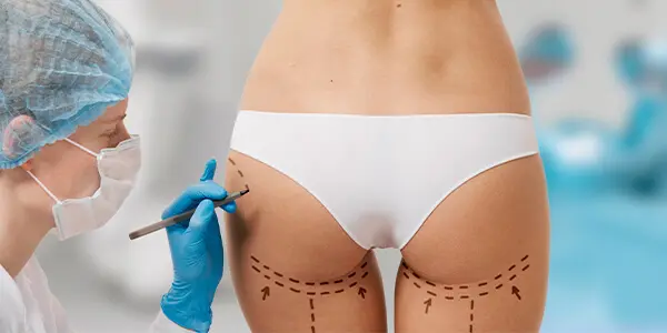 Gluteoplastia